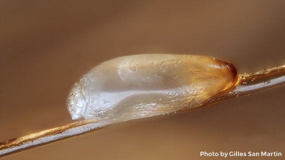 Close-up view of a louse egg on hair shaft