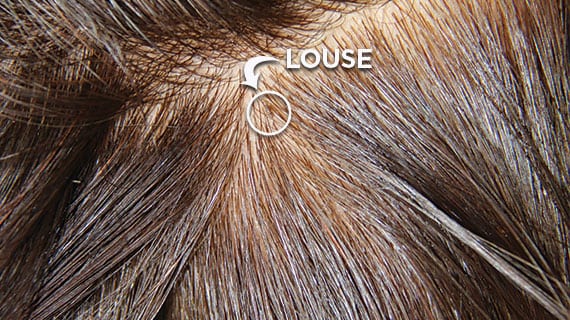 An adult lice is called a louse.